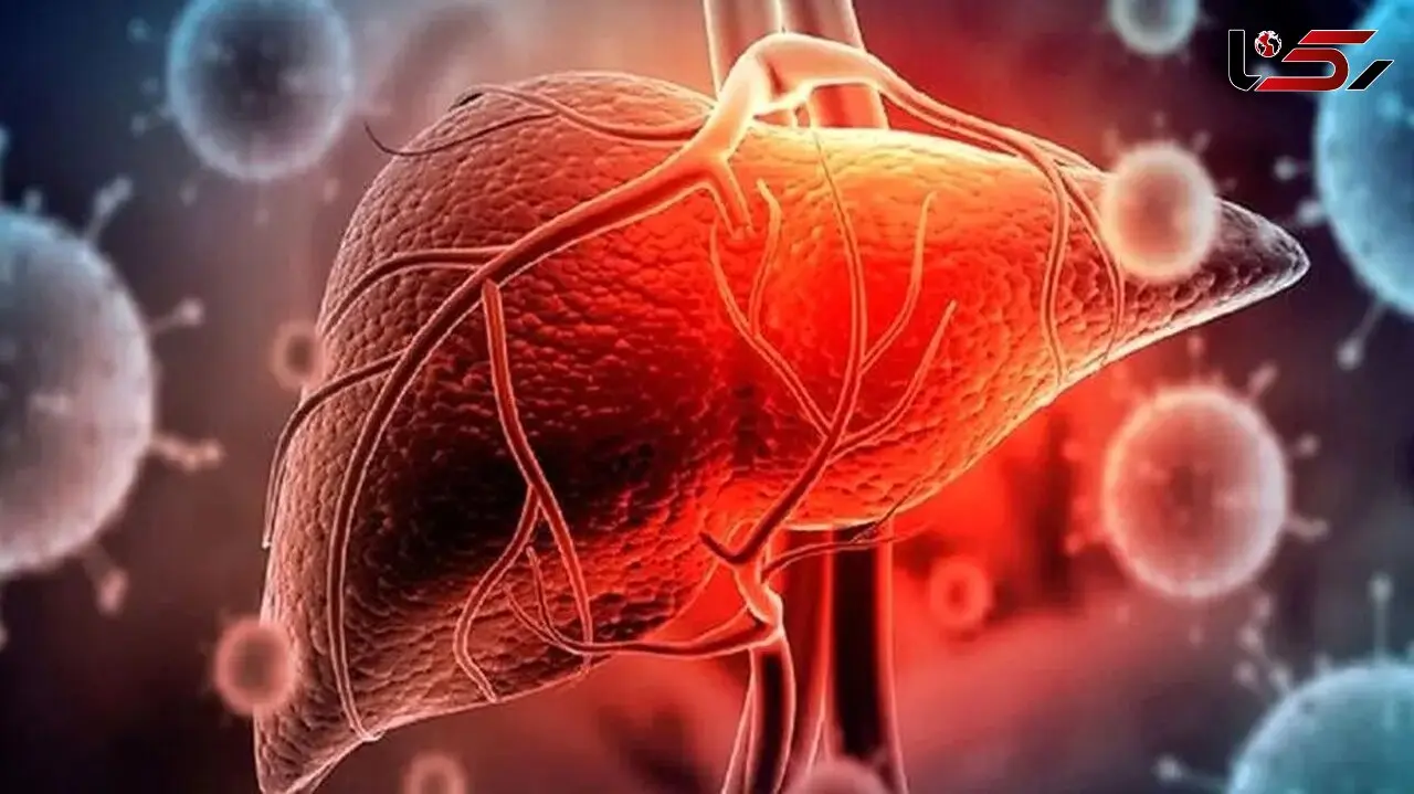 بررسی علمی علت بالا رفتن آنزیم‌ های کبدی و علائم مرتبط + پرسش و پاسخ