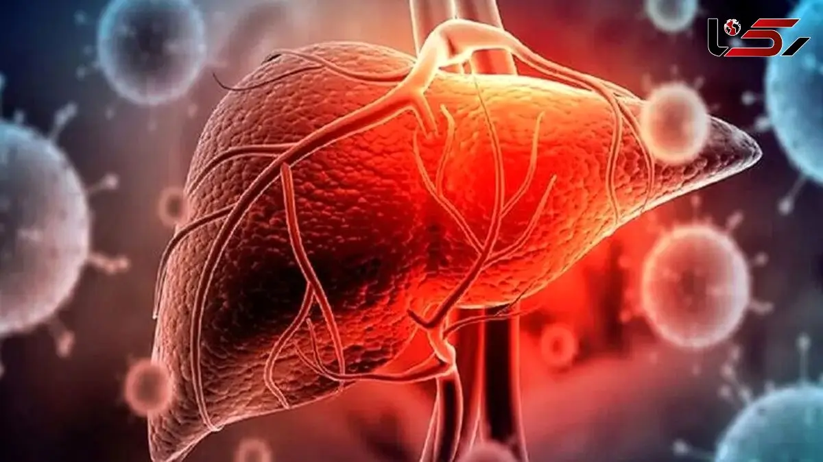 بررسی علمی علت بالا رفتن آنزیم‌ های کبدی و علائم مرتبط + پرسش و پاسخ
