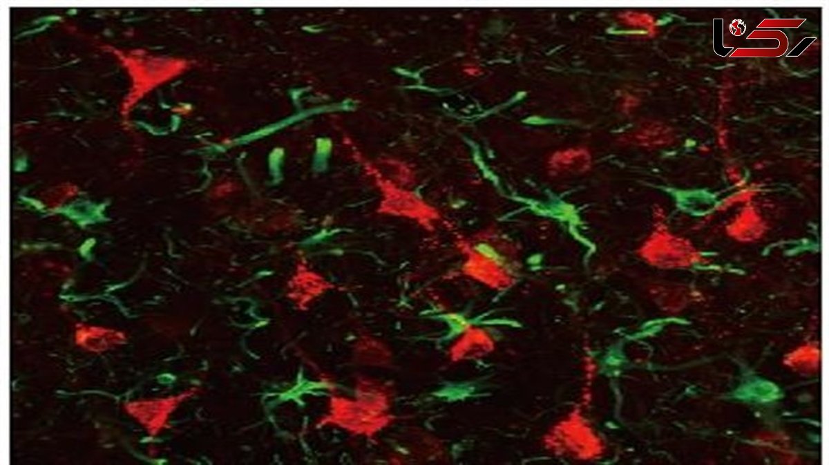 First non-human primate study showing promise of gene therapy for stroke repair