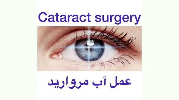 جراحی آب مروارید چشم + فیلم 
