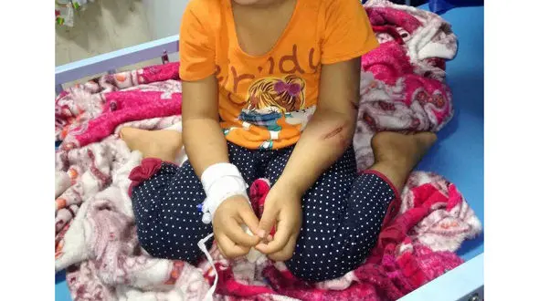 شکنجه های تلخ  دختر 4 ساله توسط عموی جوانش در شادگان +عکس