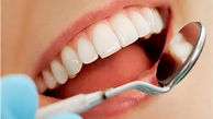 مراقبت های ضروری بعد از کشیدن دندان