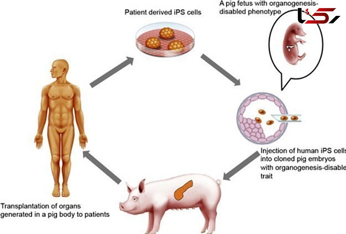 تولید لوزالمعده انسان از طریق خوک