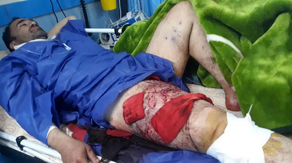 2 مرد اصفهانی را به رگبار بستند +عکس تلخ 