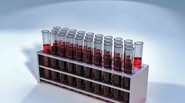 خونت غلیظ است اگر ... 