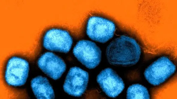 هشدار جهانی درباره آبله میمون؛ آیا ویروس به انسان منتقل می‌ شود؟