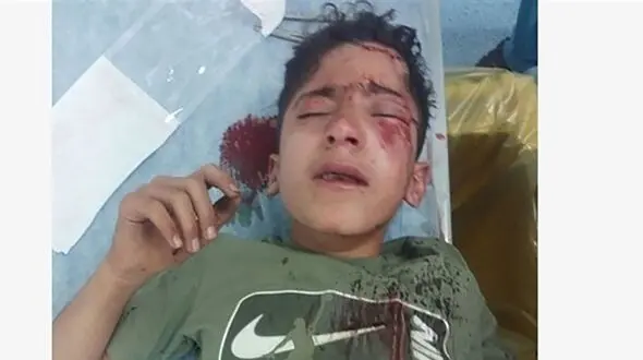 جدیدترین خبر از کولبر 14 ساله که جلوی چشمان مادرش به شدت زخمی شد
