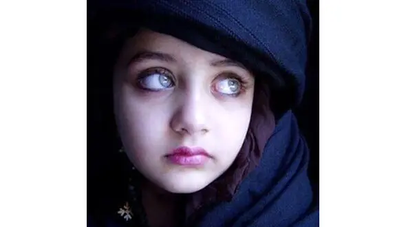 این دختر زیباترین چشم‌های جهان را دارد + عکس