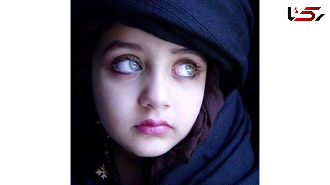 این دختر زیباترین چشم‌های جهان را دارد + عکس