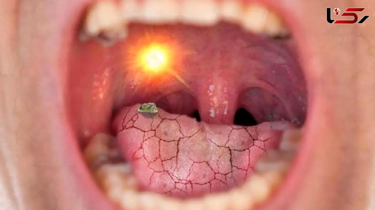 12 علت تلخی دهان + راهکار رفع تلخی دهان