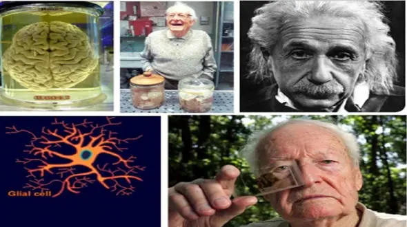 پشت پرده تشریح بدون اجازه مغز اینشتین چیست ؟ + عکس