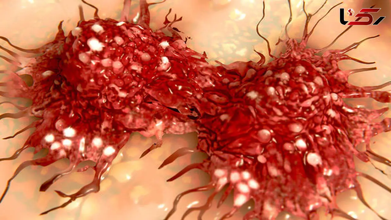 تنها یک جهش برای سرطانی شدن یک سلول کافیست