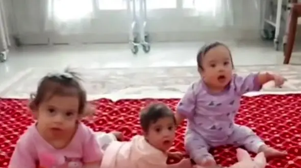 این 3 قلوهای سندرومی ملوس را سر راه گذاشتند/ سرنوشت دردناک و نامهربانی پدر و مادر 3 قلوها