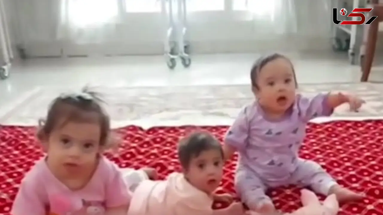 این 3 قلوهای سندرومی ملوس را سر راه گذاشتند/ سرنوشت دردناک و نامهربانی پدر و مادر 3 قلوها