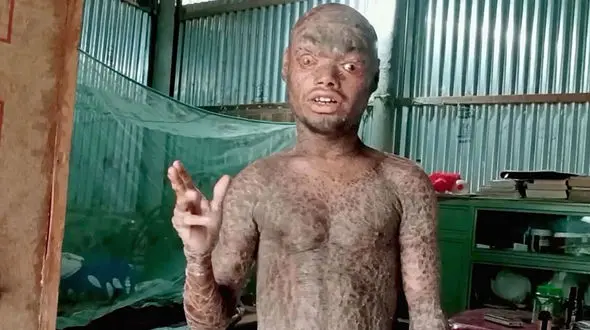 این مرد مار است ! / او هر روز کامل پوست می اندازد ! + فیلم 