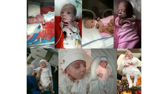 ماجرای نوزاد نیم کیلویی در قم/ لبخند رضایت پدر و مادر قمی