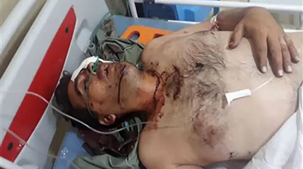 اصابت 25 گلوله به محیط‌بان مظلوم / شکارچیان خراسان جنوبی رحم نداشتند+ تصویر پیکر غرق در خون