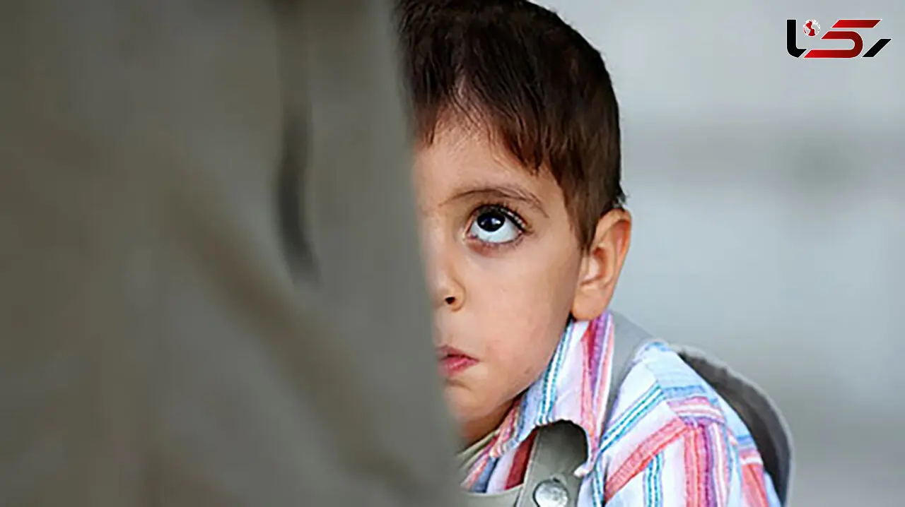 کودک آزاری وحشتناک در رفسنجان / رد دندان ناپدری روی بدن پسربچه 6 ساله + جزییات