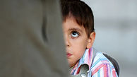 کودک آزاری وحشتناک در رفسنجان / رد دندان ناپدری روی بدن پسربچه 6 ساله + جزییات