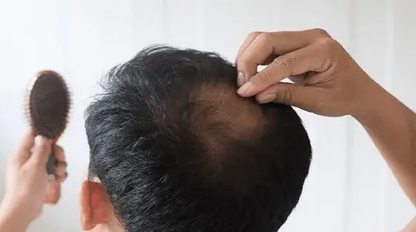 این نکته را رعایت کنید تا موهای سلامت داشته باشید