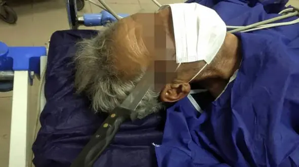 عکس چاقوی فرورفته در جمجمه مرد تهرانی / او زنده ماند 