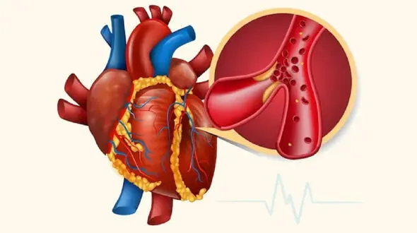 برای پایین آوردن تری گلیسیرید چه بخوریم؟ ۷ انتخاب غذایی مفید