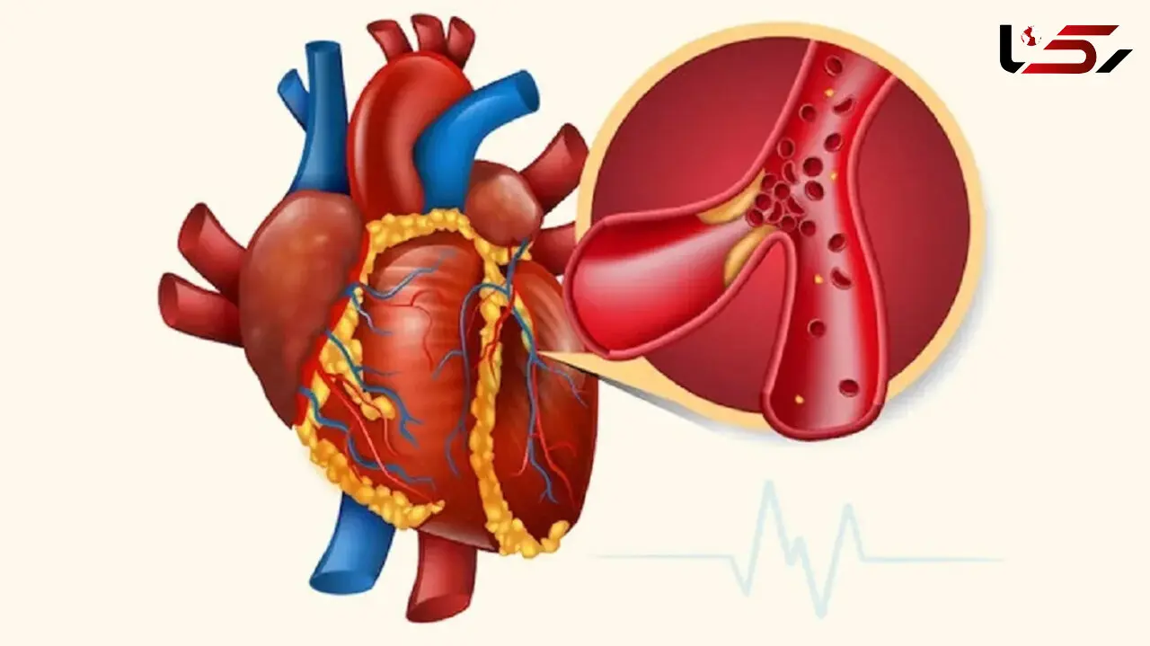 برای پایین آوردن تری گلیسیرید چه بخوریم؟ ۷ انتخاب غذایی مفید