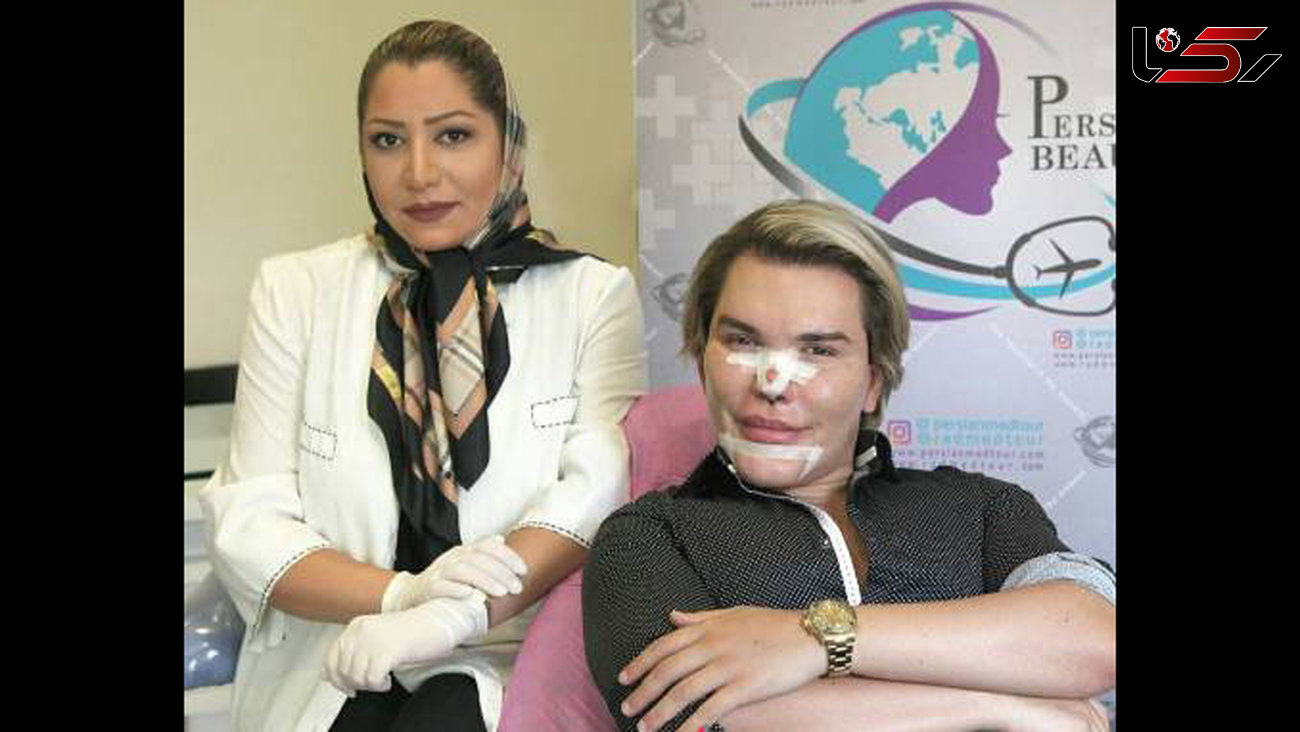  رکود ردار جراحی زیبایی برای عمل بینی به ایران آمد! عکس