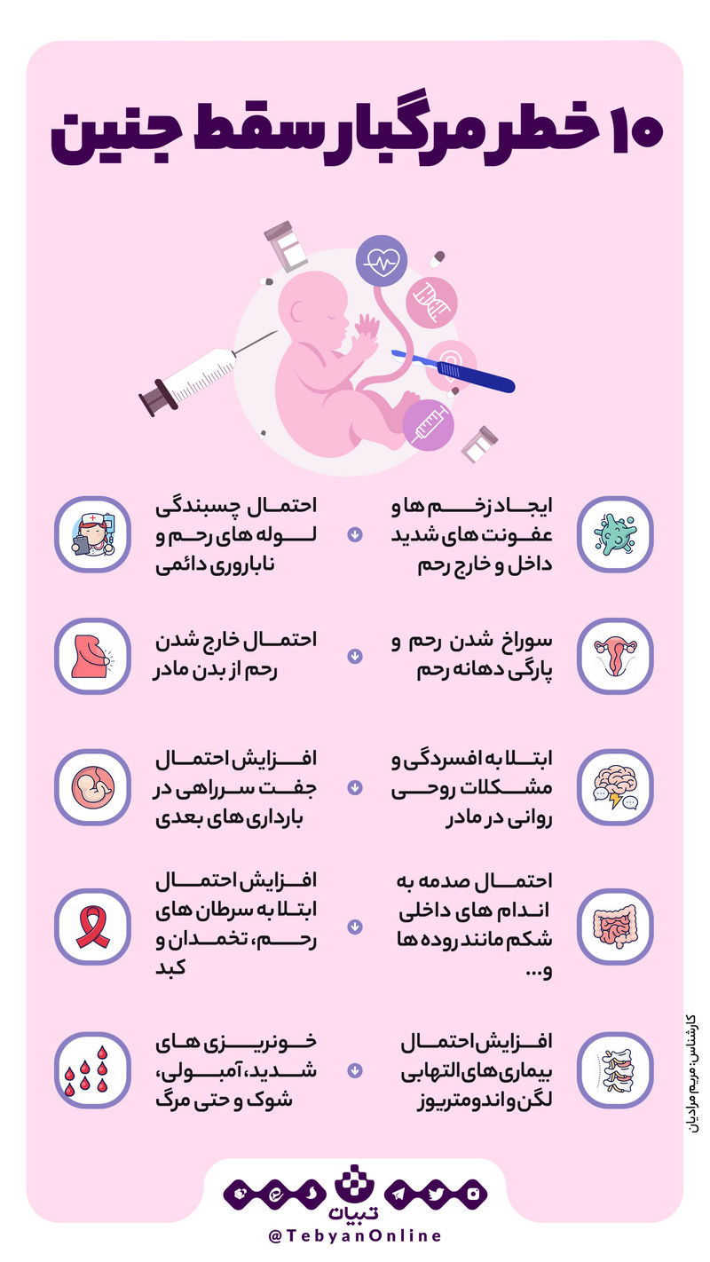 سقط عمدی جنین