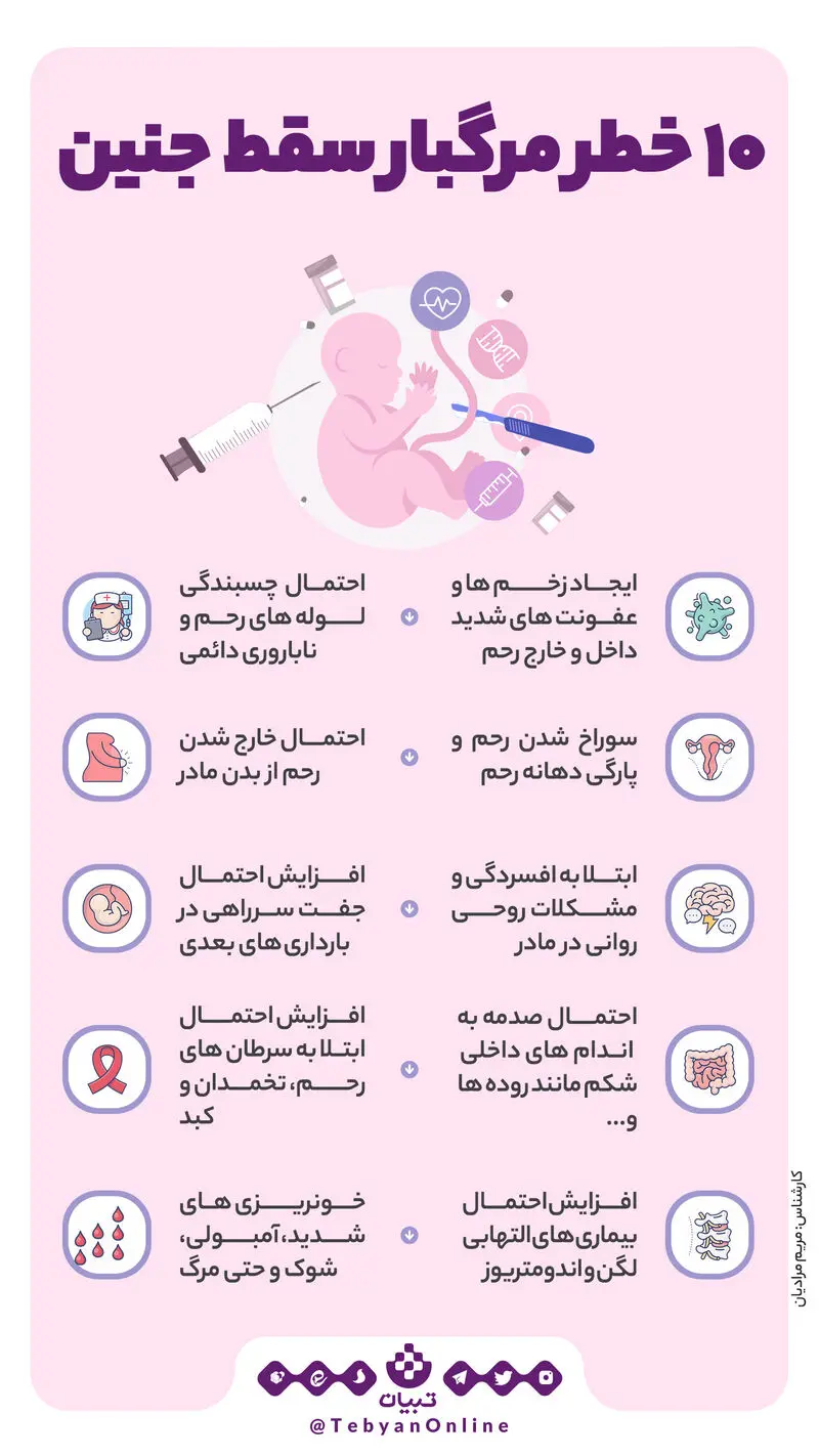 سقط عمدی جنین
