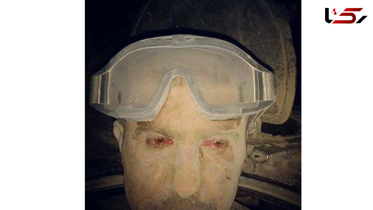 شرافت را در چشمان این سرباز سوری ببینید +عکس 