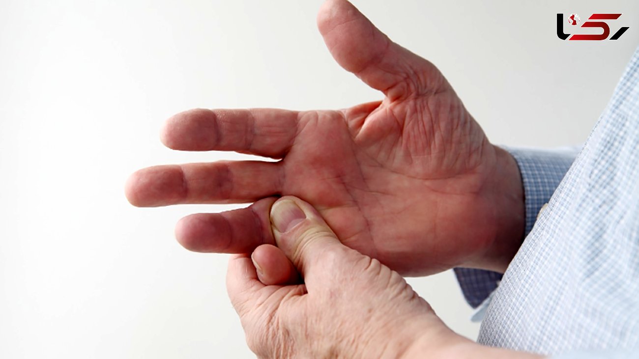 نشانه های بیماری از روی دست ها 