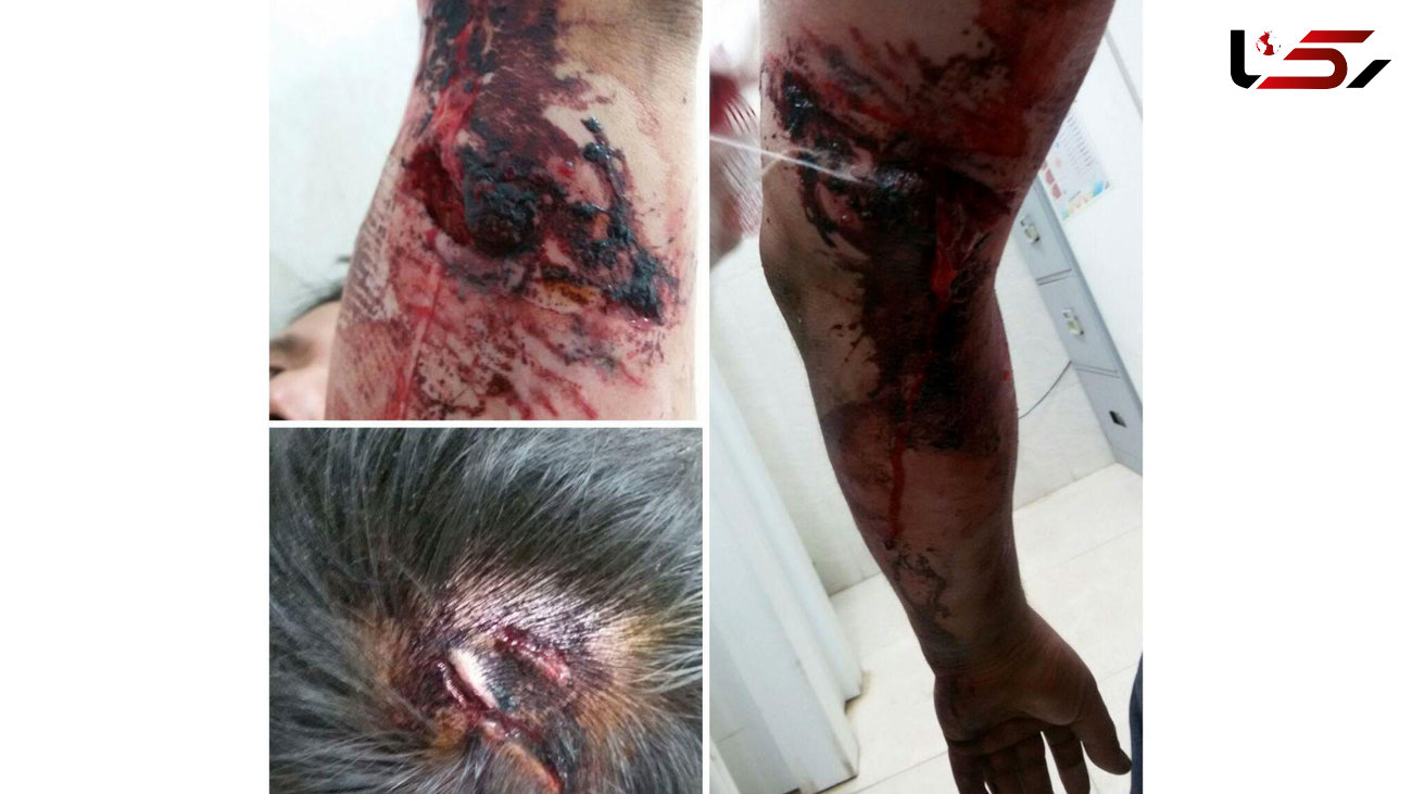 حمله خونین سگ های وحشی به پسرجوان/ در نسیم شهر رخ داد+عکس های تکاندهنده