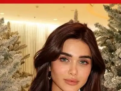 عکس ها / هیوا امین دختر ایرانی زیباترین زن خاورمیانه در سال ۲۰۲۵ شد/ عکس قبل و بعد از عمل زیبایی مدل ایرانی 