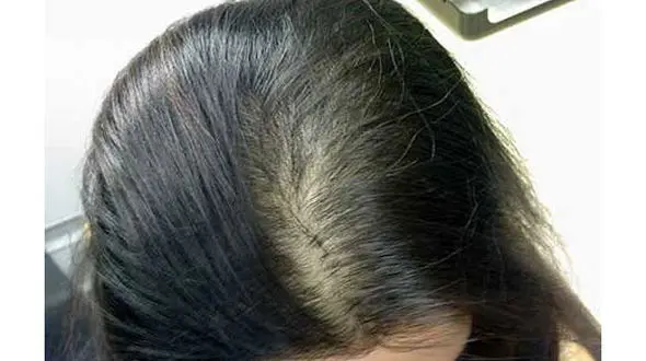 5 راه طبیعی داشتن موهای پرپشت 