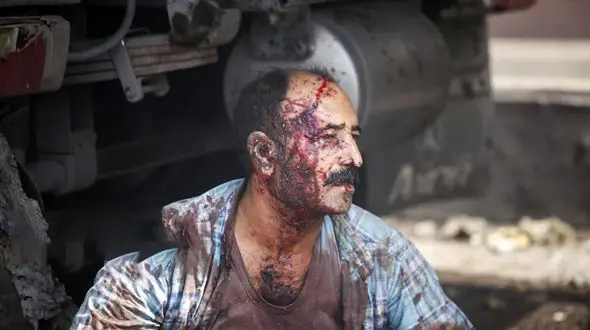 مردم بندرعباس در بهت/ نیاز به دستور وزیر کار و بهداشت برای کمک روان درمانی به شهروندان بهت زده و سوگوار 