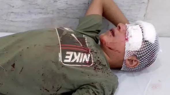 دردهای تمام نشدنی مادر مانی کولبر 14 ساله / مانی جلوی چشمان مادرش سقوط کرد+ عکس