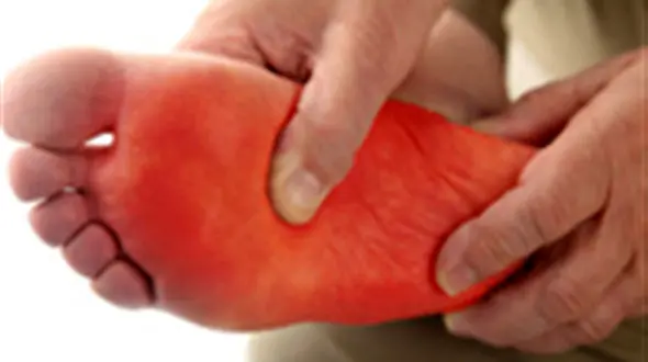 هشدار سلامتی با داغی کف پا 