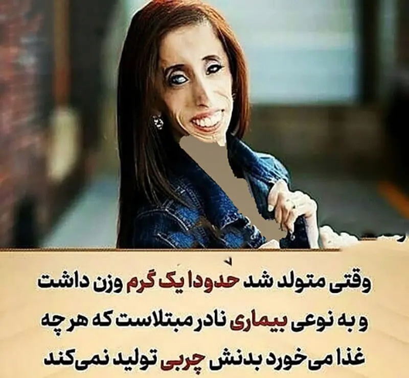 زشت ترین دختر جهان