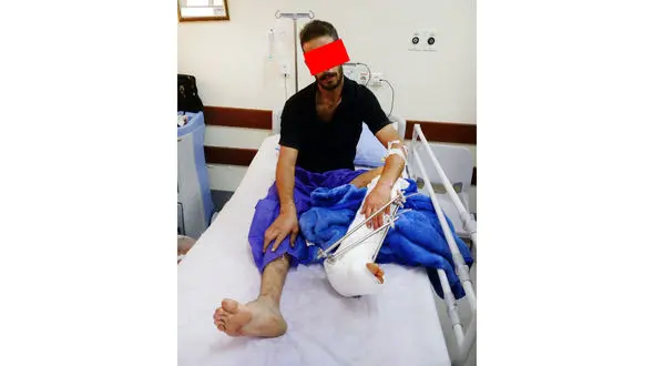 کبوترهای این دزد او را سیبل خونین گلوله پلیس کرد! + عکس