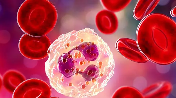 وقتی سپر بدن ضعیف می‌ شود: نشانه‌ ها و عوارض کمبود گلبول سفید