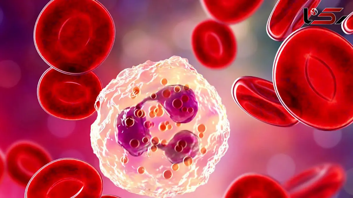 وقتی سپر بدن ضعیف می‌ شود: نشانه‌ ها و عوارض کمبود گلبول سفید
