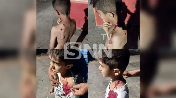 عکس دلخراش از حمله سگ های ولگرد به پسر دانش آموز در خوسف