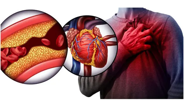 کلسترول چیست؟ + جدول ورزش و تغذیه مناسب