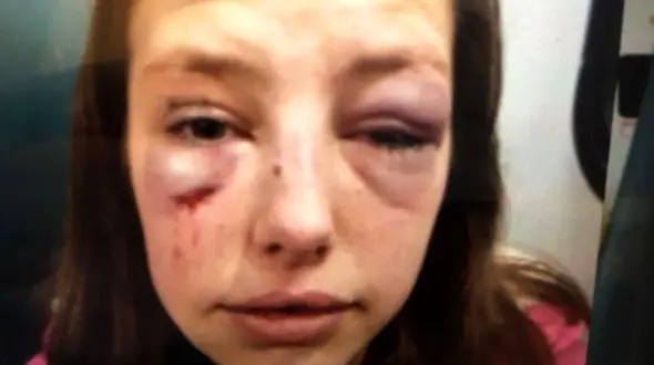 زن جوان خائن نبود اما تاوان سختی داد + عکس چهره کبود زن