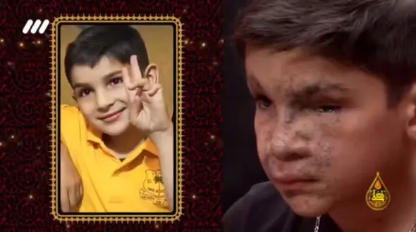 فیلم نوحه خوانی کودک 10 ساله ای که از انفجار پیجرهای لبنان نجات پیدا کرد / چهره نشان دهنده فاجعه است