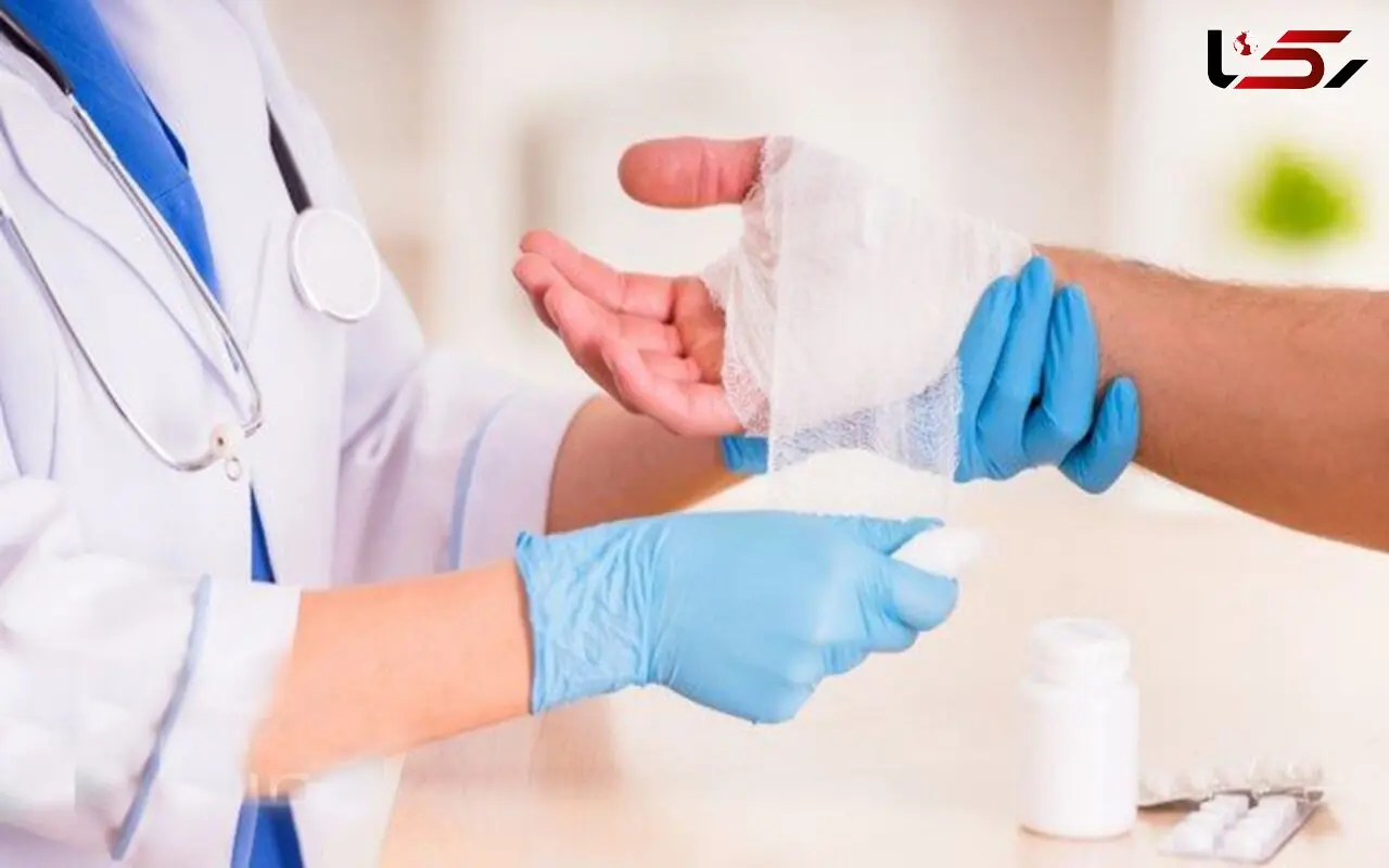 روش های خانگی معجزه آسا در درمان سوختگی