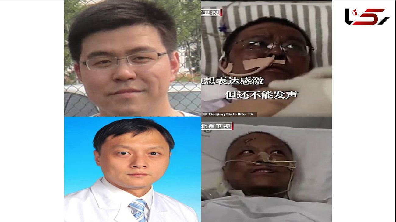 کرونا رنگ پوست 2 پزشک چینی را تغییر داد + عکس