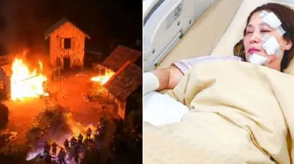 جزئیات آتش سوزی وحشتناک بازیگران زن و مرد در  یک در صحنه فیلمبرداری +فیلم و عکس