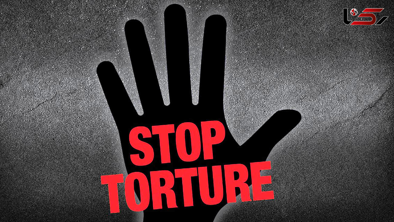 شکنجه بی رحمانه دختر6 ساله به دست ناپدری 